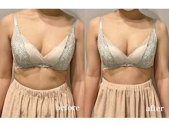 ティアモ(Ti Amo)/Before/After