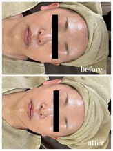 ジャスミン(Jasmin)/エステティック×シェービング