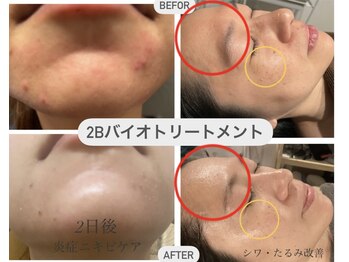 シャムリー 並木坂(Syamry)/結果を出す悩み改善ハーブ