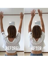 整体サロン佑/20代女性/beforeAfter