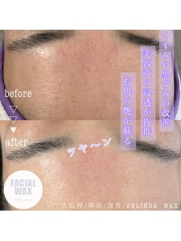 ベリンダ ワックス(BELINDA WAX)/Before &After