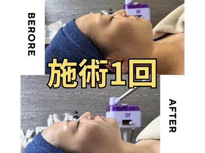 アネラ(ANELA)の写真