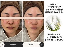 メグル(MEGURU)の雰囲気（くすみが取れ肌本来の透明感を引き出します）