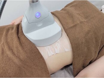 レジュ(RE:JU)の写真/【冷却ケアで集中アプローチ】二の腕/お腹/ハミ肉をキュッと引き締め！気になる部位の徹底ボディメイク◎