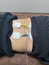 ほぐせる スター鍼灸接骨整体院 竹ノ塚 竹ノ塚東口駅前店/低周波！