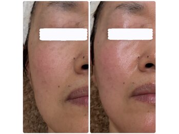 メナードフェイシャルサロン 本通り/