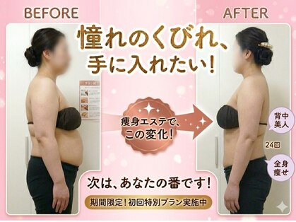 ユニクリア(Uni clear)の写真