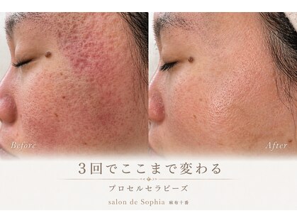 サロンドソフィア 麻布十番(salon de Sophia)の写真