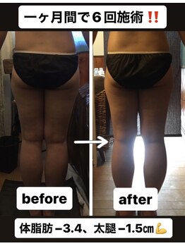 アンリール 旭川店(Anrire)/1か月で体脂肪3%減りました!