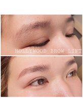 ヨリソイ(yorisoi)/HBL