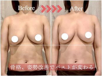 メデル(MEDEL)/ブラ無しでも変化!ヌードに自信