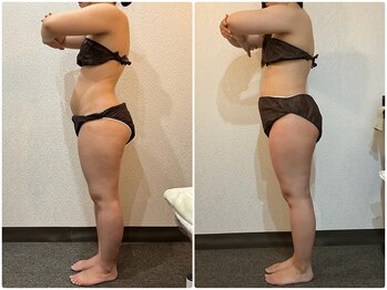 美容整体ウェリナ 名駅院/小顔矯正/骨盤矯正/美脚サロン