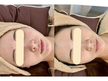 エスポワール(espoir)/before・after