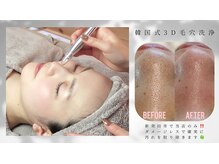 シュエット(Chouette)