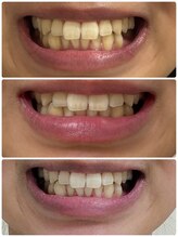 スタンド 尼崎武庫之荘店(STAND)/1ヶ月通い放題