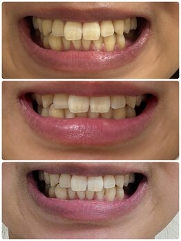 スタンド 尼崎武庫之荘店(STAND)/1ヶ月通い放題