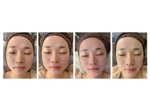 ケンジョビューティーサロン(Kenjo &nbsp;Beauty Salon)/骨格デザイン3D小顔矯正