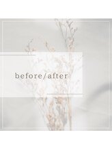 田井整体 整骨院/before/after