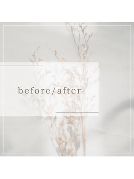 田井整体 整骨院/before/after