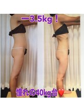 ボディエステティック アクアオーラ 富山店/美ボディ♪