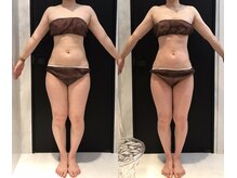 リボディ 表参道(An re Body)/before→after