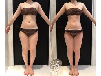 リボディ 表参道(An re Body)/before→after