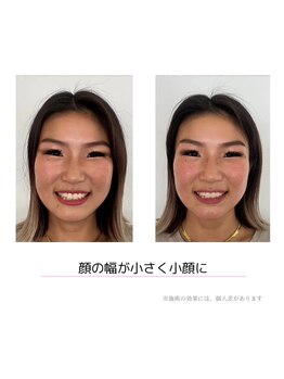 ペガサス トレーニングジム 八尾久宝寺店(Pegasus training gym)/小顔効果