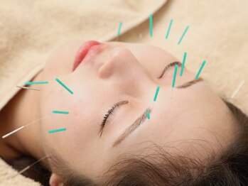 ノア鍼灸院 温灸堂(NOA鍼灸院)/