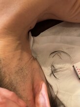 エステアンドヘアーサロン アルテ 札幌/髪の毛の脱毛