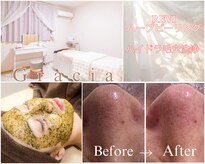 グラシア 倉敷店(Gracia)