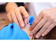 りゅうた整骨院 鍼灸院 宝塚逆瀬川店/鍼灸