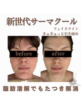 リノンクリニカル(LIINON clinical)/もたつき軽減
