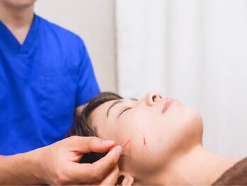 ワト(WATO)の写真/驚くほどの超ソフト美容鍼で、ほうれい線・たるみにアプローチ！若々しい肌の印象に◎