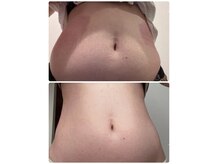 エノアシュエット(Enoachouette)の雰囲気(気になる部分を【脂肪冷却】リバウンドの心配なし!)