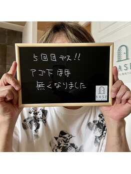 ベイス(BASE)/