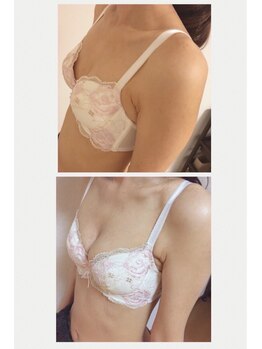 ディタ アンド ボーン(DITA&BORN)/バストアップ事例