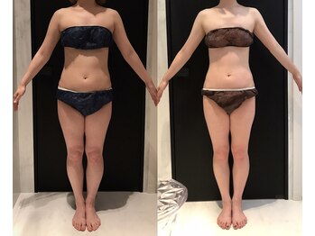 リボディ 表参道(An re Body)/before→after