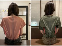 サクラ(SAKURA)/【30代】 BeforeAfter