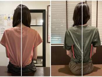 サクラ(SAKURA)/【30代】 BeforeAfter
