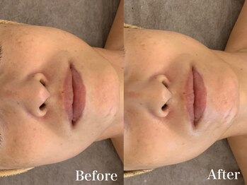 ラヴィエ ベル(La vie est belle)/REVI陶肌トリートメント