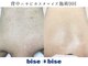 ビズビズ 梅田店(bisebise)の写真
