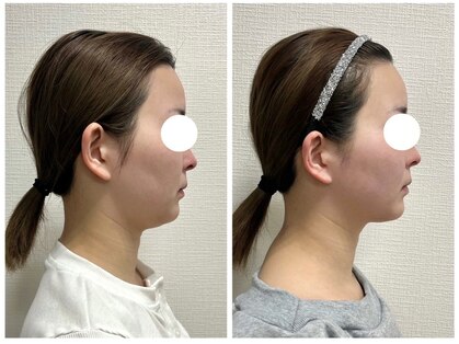 ビクシー(Bixie)の写真