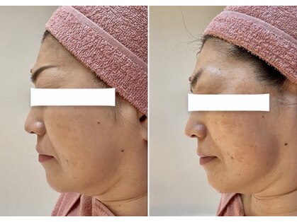 ビジュー(bijou)の写真