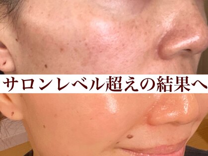 エミュ(emu)の写真