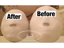 美極 銀座店/銀座/小顔コルギ/小顔矯正