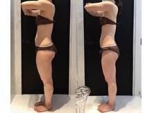 リボディ 表参道(An re Body)/before→after