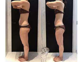 リボディ 表参道(An re Body)/before→after