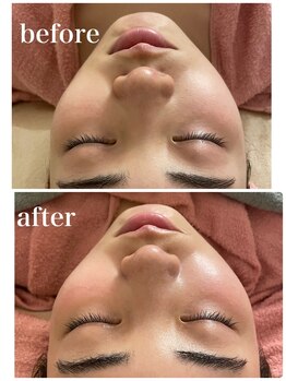 シャインクラフト/