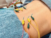 富山ふじい鍼灸整体院/腰痛やしびれに鍼でアプローチ