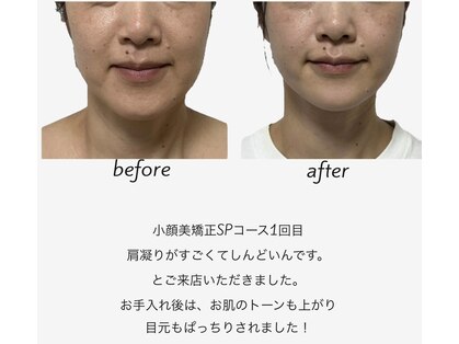 シュクラン(SHUKRAN)の写真